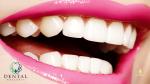 Teeth, Cleaning Tooth, Appliances, Tests,, Tooth Whitening