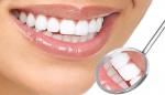 Cleaning Tooth, Teeth,, Tooth Whitening