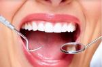 Δόντια, Καθαρισμός δοντιών, Εξετάσεις, Λεύκανση δοντιών