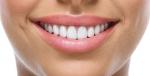 Δόντια, Καθαρισμός δοντιών, Εξετάσεις, Λεύκανση δοντιών